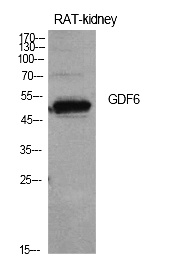 Fig.1. Western Blot analysis of rat kidney cells using GDF-6 Polyclonal Antibody. Antibody was diluted at 1:500. Secondary antibody (catalog#: A21020) was diluted at 1:20000.
