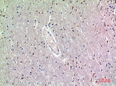 Fig.2. Immunohistochemical analysis of paraffin-embedded human-brain, antibody was diluted at 1:200.