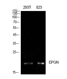 Fig.1. Western Blot analysis of 293T, 823 cells using Epigen Polyclonal Antibody. Antibody was diluted at 1:500. Secondary antibody (catalog#: A21020) was diluted at 1:20000.