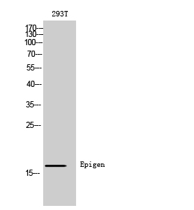 Fig.2. Western Blot analysis of 293T cells using Epigen Polyclonal Antibody diluted at 1:500. Secondary antibody (catalog#: A21020) was diluted at 1:20000.