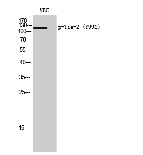 Fig. Western Blot analysis of VEC cells using Phospho-Tie-2 (Y992) Polyclonal Antibody.