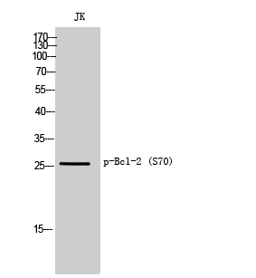 Fig.1. Western Blot analysis of JK cells using Phospho-Bcl-2 (S70) Polyclonal Antibody.