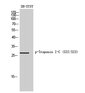 Fig. Western Blot analysis of SH-SY5Y cells using Phospho-Troponin I-C (S22/S23) Polyclonal Antibody diluted at 1:1000.