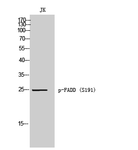 Fig. Western Blot analysis of JK cells using Phospho-FADD (S191) Polyclonal Antibody.