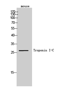 Fig. Western Blot analysis of Mouse cells using Troponin I-C Polyclonal Antibody. Secondary antibody (catalog#: A21020) was diluted at 1:20000.