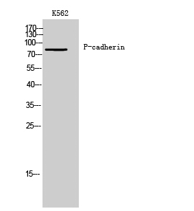 Fig. Western Blot analysis of K562 cells using P-cadherin Polyclonal Antibody.