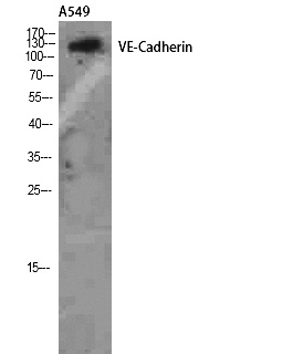 Fig.2. Western Blot analysis of A549 using VE-Cadherin Polyclonal Antibody. Antibody was diluted at 1:2000. Secondary antibody (catalog#: A21020) was diluted at 1:20000.