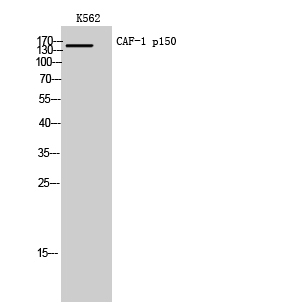 Fig. Western Blot analysis of K562 cells using CAF-1 p150 Polyclonal Antibody. Secondary antibody (catalog#: A21020) was diluted at 1:20000.