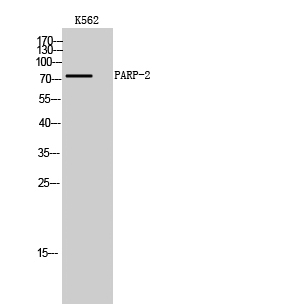 Fig. Western Blot analysis of K562 cells using PARP-2 Polyclonal Antibody.