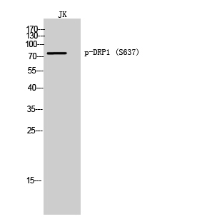 Fig. Western Blot analysis of JK cells using Phospho-DRP1 (S637) Polyclonal Antibody.