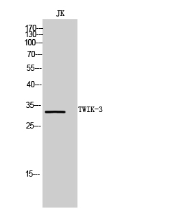 Fig. Western Blot analysis of JK cells using TWIK-3 Polyclonal Antibody. Secondary antibody (catalog#: A21020) was diluted at 1:20000.