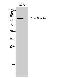 Fig. Western Blot analysis of LOVO cells using T-cadherin Polyclonal Antibody.