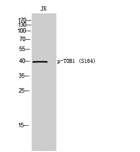 Fig. Western Blot analysis of JK cells using Phospho-TOB1 (S164) Polyclonal Antibody.