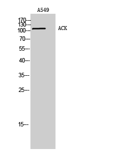 Fig. Western Blot analysis of A549 cells using ACK Polyclonal Antibody. Secondary antibody (catalog#: A21020) was diluted at 1:20000.