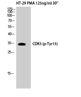 Fig. Western Blot analysis of HT29+PMA cells using Phospho-Cdk5 (Y15) Polyclonal Antibody.