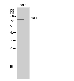 Fig. Western Blot analysis of COLO cells using CNK1 Polyclonal Antibody.