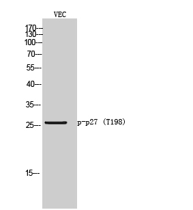 Fig. Western Blot analysis of VEC cells using Phospho-p27 (T198) Polyclonal Antibody.