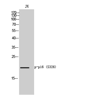 Fig.1. Western Blot analysis of JK cells using Phospho-p16 (S326) Polyclonal Antibody diluted at 1:500.