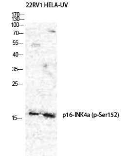 Fig.2. Western Blot analysis of 22RV1 HELA cells using Phospho-p16 (S326) Polyclonal Antibody diluted at 1:500.