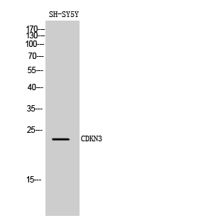 Fig. Western Blot analysis of SH-SY5Y cells using CDKN3 Polyclonal Antibody diluted at 1:1000.