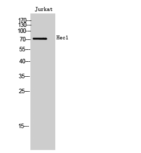 Fig. Western Blot analysis of Jurkat cells using Hec1 Polyclonal Antibody.