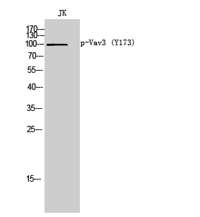 Fig. Western Blot analysis of JK cells using Phospho-Vav3 (Y173) Polyclonal Antibody.