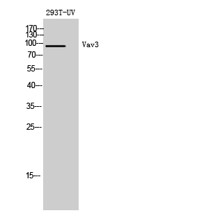 Fig. Western Blot analysis of 293T-UV cells using Vav3 Polyclonal Antibody diluted at 1:500. Secondary antibody (catalog#: A21020) was diluted at 1:20000.