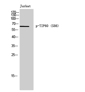 Fig. Western Blot analysis of Jurkat cells using Phospho-TIP60 (S86) Polyclonal Antibody.