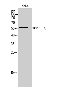 Fig. Western Blot analysis of HeLa cells using TCP-1 η Polyclonal Antibody.
