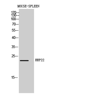 Fig. Western Blot analysis of Mouse-SPLEEN cells using RRP22 Polyclonal Antibody diluted at 1:1000.