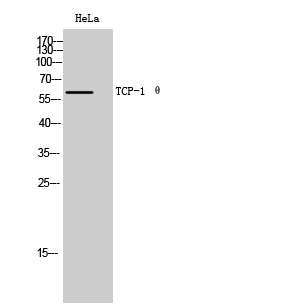 Fig. Western Blot analysis of HeLa cells using TCP-1 θ Polyclonal Antibody.