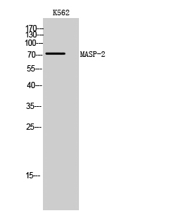 Fig. Western Blot analysis of K562 cells using MASP-2 Polyclonal Antibody.