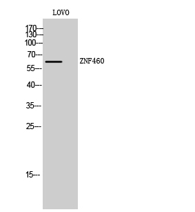 Fig. Western Blot analysis of LOVO cells using ZNF460 Polyclonal Antibody. Secondary antibody (catalog#: A21020) was diluted at 1:20000.
