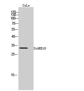 Fig. Western Blot analysis of CoLo cells using StARD10 Polyclonal Antibody.