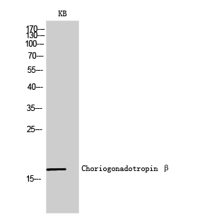 Fig. Western Blot analysis of KB cells using Choriogonadotropin β Polyclonal Antibody diluted at 1:2000.