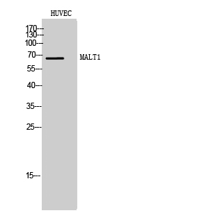 Fig. Western Blot analysis of HUVEC cells using MALT1 Polyclonal Antibody.