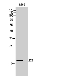 Fig. Western Blot analysis of k562 cells using JTB Polyclonal Antibody.