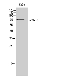 Fig. Western Blot analysis of Hela cells using ACSVL6 Polyclonal Antibody diluted at 1:1000.
