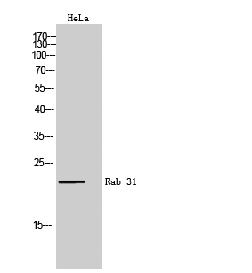 Fig. Western Blot analysis of HeLa cells using Rab 31 Polyclonal Antibody.