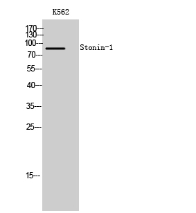 Fig. Western Blot analysis of K562 cells using Stonin-1 Polyclonal Antibody.