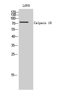 Fig. Western Blot analysis of LOVO cells using Calpain 10 Polyclonal Antibody.