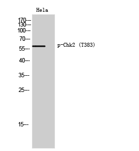 Fig. Western Blot analysis of Hela cells using Phospho-Chk2 (T383) Polyclonal Antibody diluted at 1:1000.
