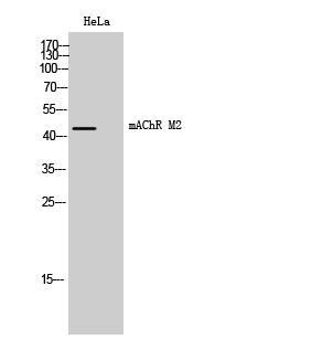 Fig. Western Blot analysis of HeLa cells using mAChR M2 Polyclonal Antibody.