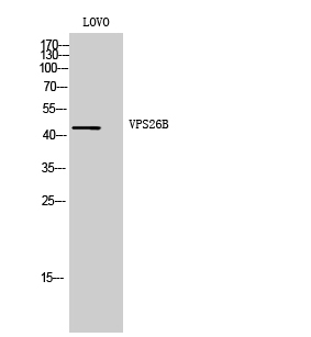 Fig. Western Blot analysis of LOVO cells using VPS26B Polyclonal Antibody. Secondary antibody (catalog#: A21020) was diluted at 1:20000.