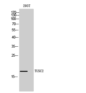 Fig. Western Blot analysis of 293T cells using TUSC2 Polyclonal Antibody diluted at 1:1000. Secondary antibody (catalog#: A21020) was diluted at 1:20000.