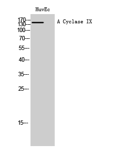 Fig. Western Blot analysis of HuvEc cells using A Cyclase IX Polyclonal Antibody diluted at 1:1000.