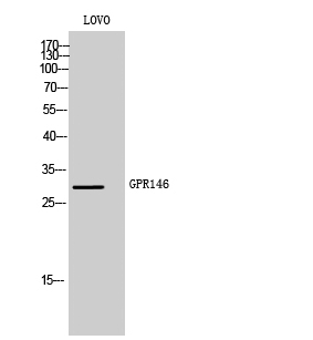 Fig. Western Blot analysis of LOVO cells using GPR146 Polyclonal Antibody.