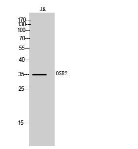 Fig. Western Blot analysis of JK cells using OSR2 Polyclonal Antibody.
