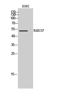Fig. Western Blot analysis of K562 cells using RAB3IP Polyclonal Antibody.