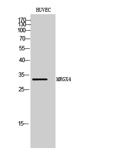Fig. Western Blot analysis of HUVEC cells using MRGX4 Polyclonal Antibody.